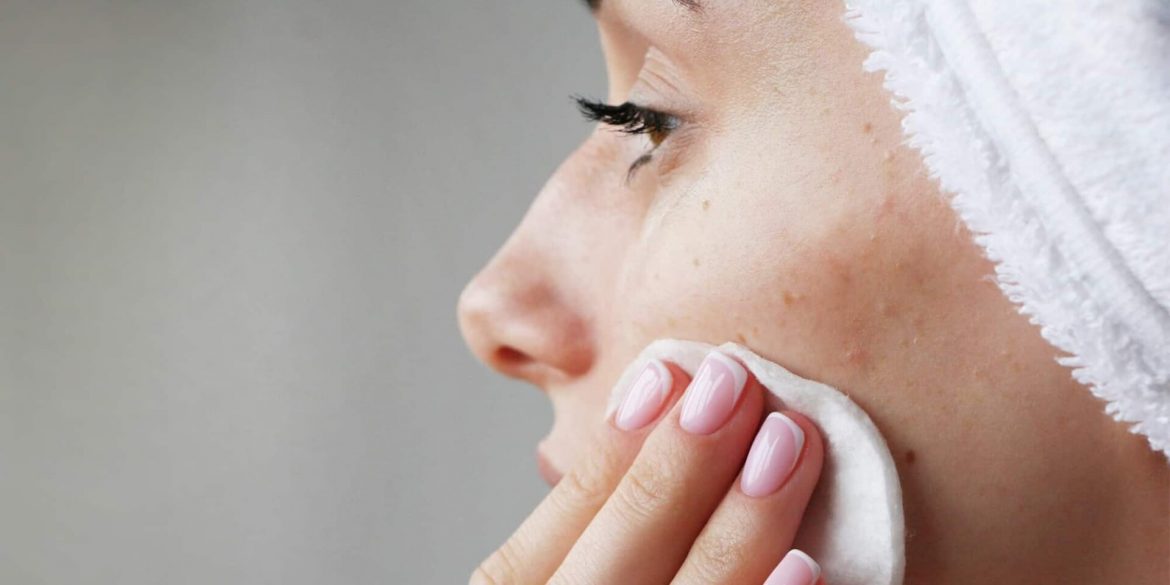 Hyperpigmentation: Causes and Treatments